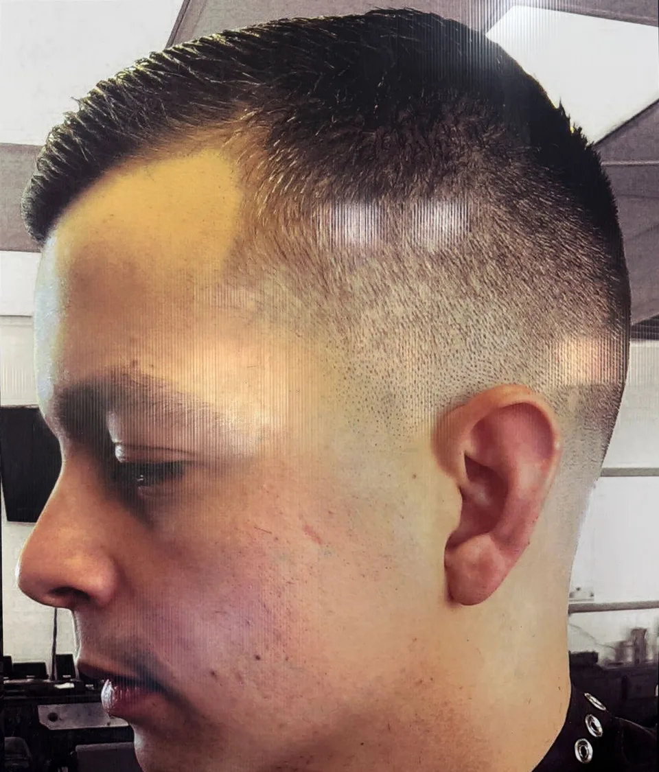 A high skin fade with a short textured top